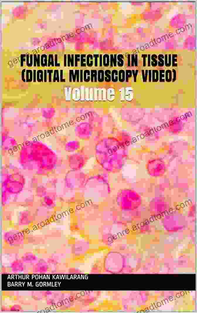 Fungal Infections In Tissue Digital Microscopy Video Volume Book Fungal Infections In Tissue (Digital Microscopy Video): Volume 3