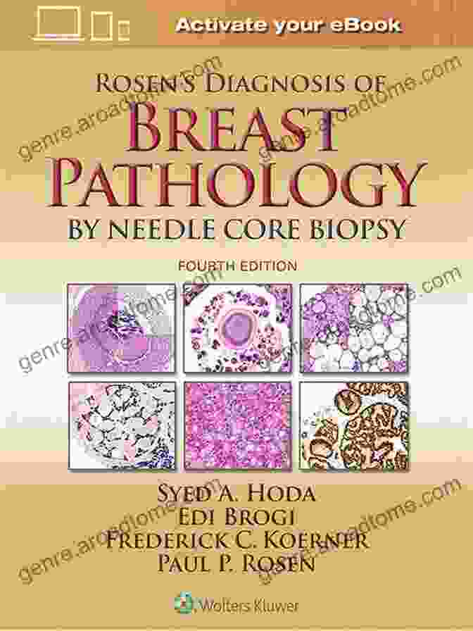 Rosen Diagnosis Of Breast Pathology By Needle Core Biopsy Book Cover Rosen S Diagnosis Of Breast Pathology By Needle Core Biopsy