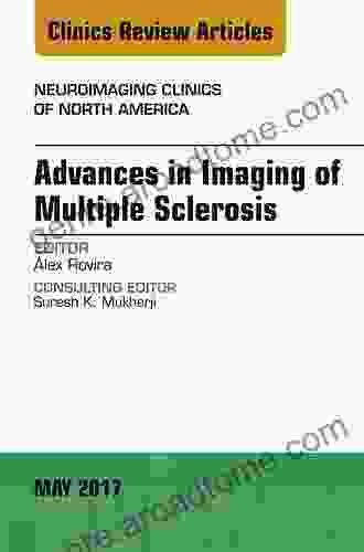 Advances In Imaging Of Multiple Sclerosis An Issue Of Neuroimaging Clinics Of North America (The Clinics: Radiology 27)